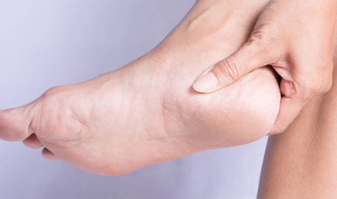 plantar fascia